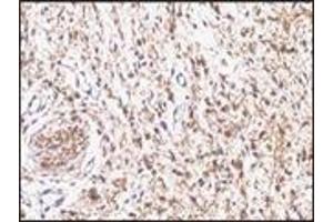 Immunohistochemistry (IHC) image for anti-S-100 (C-Term) antibody (ABIN870449) (S-100 anticorps  (C-Term))