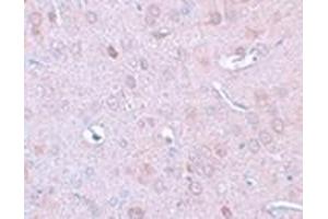 Immunohistochemistry of DLCK1 in rat brain tissue with DLCK1 antibody at 2.