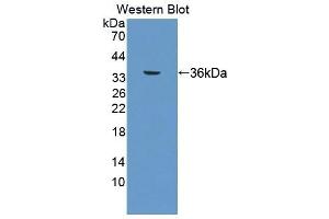 Detection of Recombinant TP, Human using Polyclonal Antibody to Thromboxane Receptor (TP) (TBXA2R anticorps  (AA 3-324))