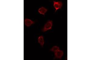 ABIN6276899 staining NIH-3T3 by IF/ICC. (Prosaposin anticorps  (Internal Region))