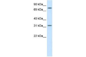WB Suggested Anti-WNT8B Antibody Titration:  1. (WNT8B anticorps  (Middle Region))