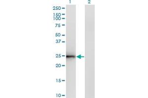 Western Blot analysis of CIDEB expression in transfected 293T cell line by CIDEB monoclonal antibody (M01), clone 2A10.