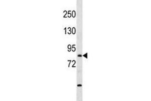 TBR1 antibody western blot analysis in mouse bladder tissue lysate (TBR1 anticorps  (AA 52-80))