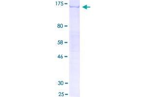 Image no. 1 for Signal Peptide, CUB Domain, EGF-Like 1 (SCUBE1) (AA 1-988) protein (GST tag) (ABIN2566076)