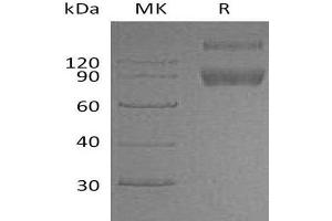 Western Blotting (WB) image for Interleukin 1 Receptor, Type II (IL1R2) protein (Fc Tag) (ABIN7320552)