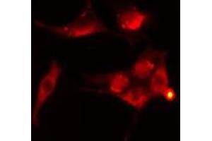 ABIN6276416 staining  Hela cells by IF/ICC. (TRAF2 anticorps  (C-Term))