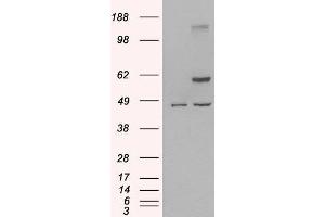 HEK293 overexpressing Human TRAF2 and probed with ABIN2560516 (mock transfection in first lane). (TRAF2 anticorps  (C-Term))