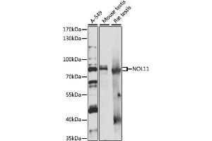 Western blot analysis of extracts of various cell lines, using NOL11 antibody (ABIN7269032) at 1:1000 dilution. (NOL11 anticorps  (AA 300-600))