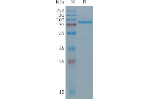 Human (24-609) Protein, His Tag on SDS-PAGE under reducing condition.