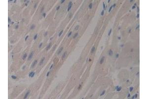 Detection of MUC1 in Mouse Heart Tissue using Polyclonal Antibody to Mucin 1 (MUC1)