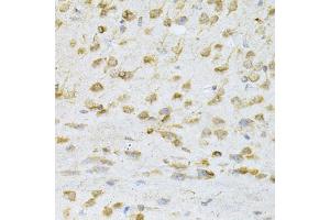 Immunohistochemistry of paraffin-embedded mouse brain using VAPB Antibody. (VAPB anticorps)
