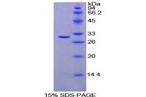 SDS-PAGE analysis of Chicken Carbonic Anhydrase II Protein. (CA2 Protéine)