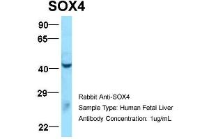 Host:  Rabbit  Target Name:  SOX4  Sample Type:  Human Fetal Liver  Antibody Dilution:  1.