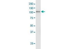 EPHA3 monoclonal antibody (M01), clone 3A12.