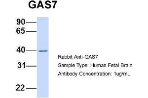Host:  Rabbit  Target Name:  GAS7  Sample Type:  Human Fetal Brain  Antibody Dilution:  1. (GAS7 anticorps  (N-Term))