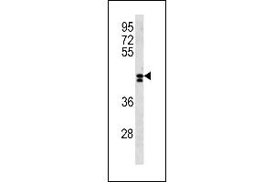 LRRC2 Antibody (N-term) (ABIN1881510 and ABIN2843288) western blot analysis in NCI- cell line lysates (35 μg/lane). (LRRC2 anticorps  (N-Term))