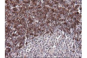 Immunohistochemistry (IHC) image for anti-T-cell surface glycoprotein CD1c (CD1C) antibody (ABIN2670658) (CD1c anticorps)