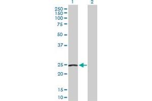 Western Blot analysis of NDUFS8 expression in transfected 293T cell line by NDUFS8 MaxPab polyclonal antibody.