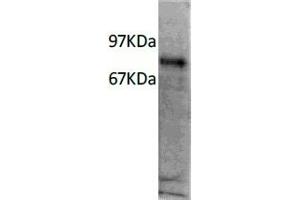 Western Blotting (WB) image for anti-Interleukin 7 Receptor (IL7R) antibody (ABIN6923149) (IL7R anticorps)