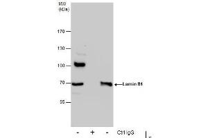 IP Image Immunoprecipitation of Lamin B1 protein from 293T whole cell extracts using 5 μg of Lamin B1 antibody, Western blot analysis was performed using Lamin B1 antibody, EasyBlot anti-Rabbit IgG  was used as a secondary reagent. (Lamin B1 anticorps)