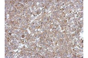 IHC-P Image Immunohistochemical analysis of paraffin-embedded Hela xenograft, using C18orf25, antibody at 1:500 dilution. (C18ORF25 anticorps)