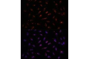anti-Deoxynucleotidyltransferase, Terminal, Interacting Protein 2 (DNTTIP2) (AA 1-300) antibody