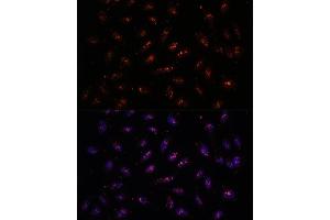 Immunofluorescence analysis of U-2 OS cells using DNTTIP2 antibody (ABIN7266732) at dilution of 1:100. (DNTTIP2 anticorps  (AA 1-300))