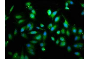 Immunofluorescence staining of Hela cells with ABIN7167474 at 1:133, counter-stained with DAPI.