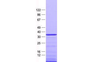 Validation with Western Blot (Nkx2-2 Protein (His tag))
