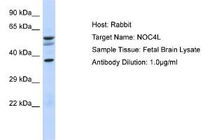 Host: Rabbit Target Name: NOC4L Sample Type: Fetal Brain lysates Antibody Dilution: 1. (NOC4L anticorps  (N-Term))