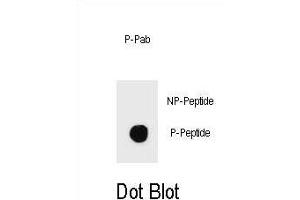 Dot blot analysis of Phospho-IKKB- Antibody Phospho-specific Pab (ABIN1539705 and ABIN2839872) on nitrocellulose membrane.