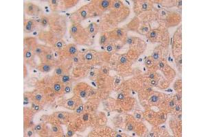Used in DAB staining on fromalin fixed paraffin- embedded Kidney tissue (LYPLA1 anticorps  (AA 1-230))
