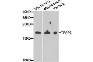 Western blot analysis of extracts of various cell lines, using TPPP3 antibody. (TPPP3 anticorps)