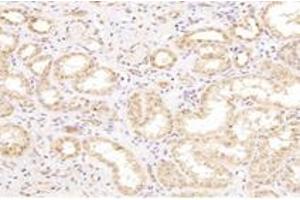 Immunohistochemistry analysis of paraffin-embedded human kidney using,CTSV (ABIN7073348) at dilution of 1: 2000 (Cathepsin L2 anticorps)