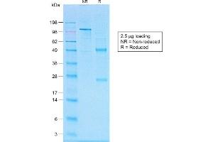 SDS-PAGE Analysis of Purified CD20 Rabbit Recombinant Monoclonal Antibody (IGEL/1497R). (Recombinant CD20 anticorps)