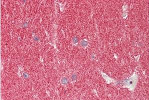 ABIN1049516 (5µg/ml) staining of paraffin embedded Human Cerebellum. (SNCA anticorps  (Internal Region))