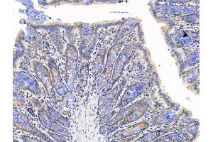 ABIN7094540 and ABIN7098589 at 1/100 staining Rat colorectal tissue by IHC-P. (GABRA5 anticorps  (C-Term))