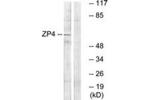 Western blot analysis of extracts from Jurkat cells, using ZP4 Antibody. (ZP4 anticorps  (AA 231-280))