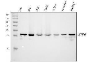 anti-Eukaryotic Translation Initiation Factor 6 (EIF6) (AA 66-210) antibody