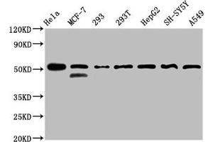 Western Blot Positive WB detected in: Hela whole cell lysate, MCF-7 whole cell lysate, 293 whole cell lysate, 293T whole cell lysate, HepG2 whole cell lysate, SH-SY5Y whole cell lysate, A549 whole cell lysate All lanes: PLAGL1 antibody at 3 μg/mL Secondary Goat polyclonal to rabbit IgG at 1/50000 dilution Predicted band size: 51, 45 kDa Observed band size: 51 kDa