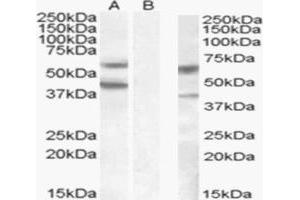 HEK293 overexpressing DGAT2 (lane A) and probed with ABIN190849 (mock transfection in laneB).
