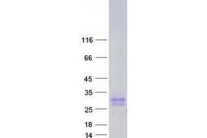 Validation with Western Blot