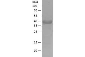 Western Blotting (WB) image for Salt-Inducible Kinase 2 (SIK2) (AA 827-926) protein (His-IF2DI Tag) (ABIN7124981)