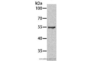 Western blot analysis of Human testis tissue, using SPATA6 Polyclonal Antibody at dilution of 1:1000 (SPATA6 anticorps)