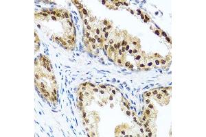 Immunohistochemistry of paraffin-embedded human prostate using RAD23B antibody.