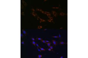 Immunofluorescence analysis of NIH/3T3 cells using  Rabbit pAb (ABIN7265726) at dilution of 1:100 (40x lens). (ABCA1 anticorps  (AA 1870-2120))