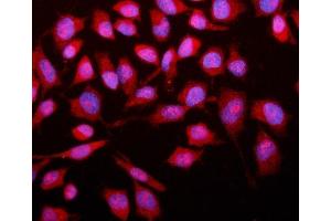 IF analysis of SMAD2 using anti-SMAD2 antibody (ABIN6719361). (SMAD2 anticorps  (AA 83-264))