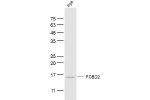 Ray eye lysates probed with PCBD2 Polyclonal Antibody, Unconjugated  at 1:300 dilution and 4˚C overnight incubation. (PCBD2 anticorps  (AA 31-130))