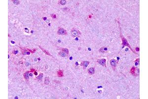 Anti-OR6N1 antibody IHC of human brain, cortex, neurons.
