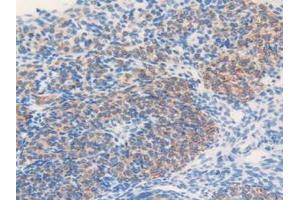 Detection of MGST1 in Mouse Ovary Tissue using Polyclonal Antibody to Microsomal Glutathione S Transferase 1 (MGST1)